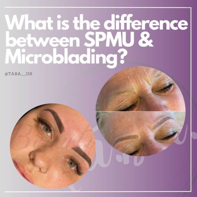 𝗔 𝗾𝘂𝗲𝘀𝘁𝗶𝗼𝗻 𝘄𝗲 𝗴𝗲𝘁 𝗮𝘀𝗸𝗲𝗱 𝗮 𝗹𝗼𝘁….

First of all, it is important to know what “SPMU” actually stands for. Semi-Permanent makeup is a technique that requires a specialist tattoo machine.

When it comes to Eyebrows, the beauty industry often refers to this as a “Powder Brow”. It is a much bolder, more defined finish to the Brow with a far longer lasting result. This treatment is done using a specialist facial tattooing machine, which works at a much lower frequency than a standard tattoo machine.

Simply put, the difference between Microblading and SPMU eyebrows is everything; from the technique, the finished look, the shading to even the healed result and the top-up process.

Microblading is the method of Eyebrow tattooing that requires a specialist handheld blade that’s been dipped into the pigment the client is matched up with. The blade then gently cuts individual fine hairlines into the skin which gives the closest results to that of a natural-looking brow.

Because it requires a hand-held blade, it is far more accessible to intricately mimic the exact direction of the clients natural hair growth. The pigment is placed by the blade into a higher layer of the skin compared to that of machine tattooing- thus meaning the final result is less permanent.

💻 https://tabauk.com/
📧 sales@tabauk.com
📞 0151 345 6597